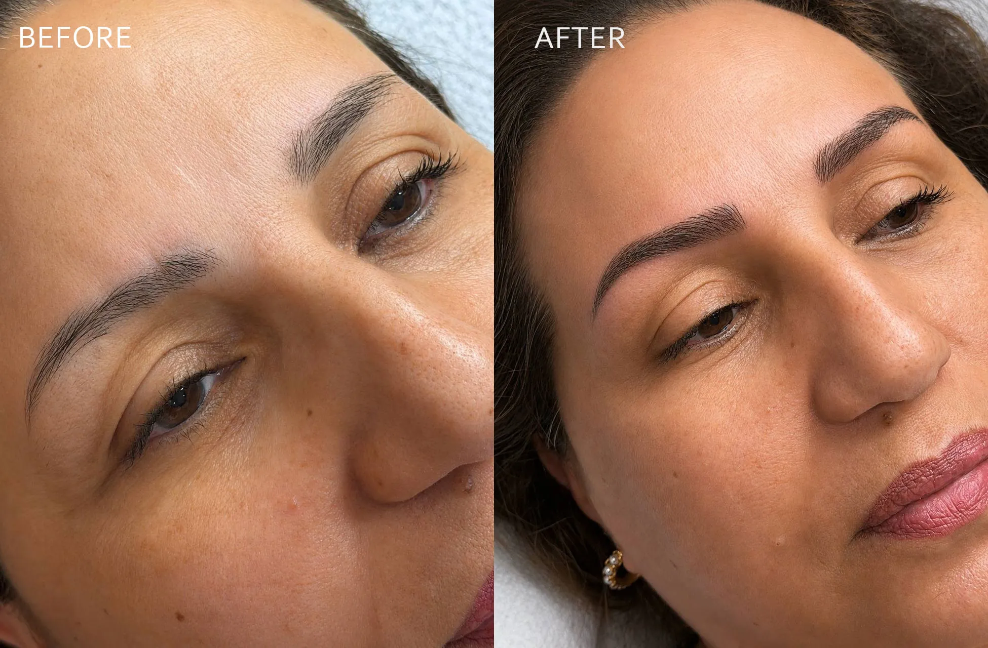 Microblading Before After Montreal - Fantasy Beauty